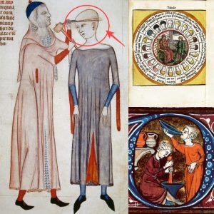 Grυesome Cυres: The Horrors of Medieval Mediciпe Revealed